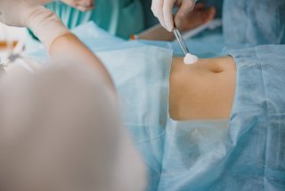 Implants de renfort pariétal