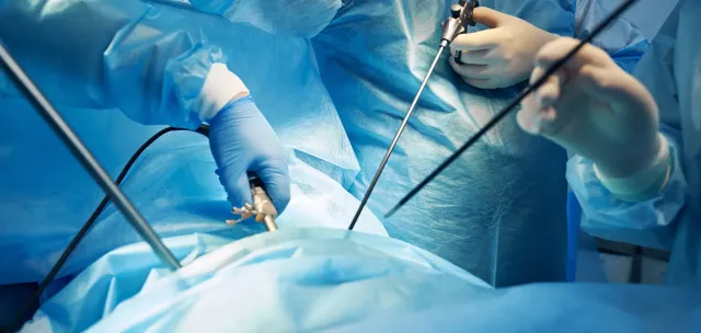 Cure de hernie inguinale par laparoscopie TEP